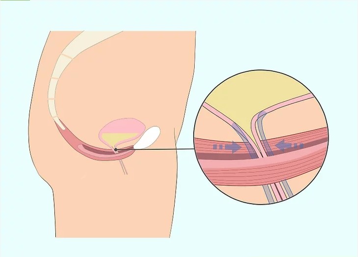 How to Do Kegel Exercises post thumbnail image